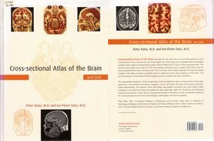 Cross-sectional Atlas of the Brain